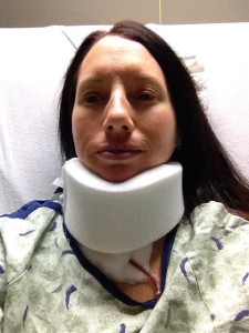 picture of me after cervical double disc replacement surgery