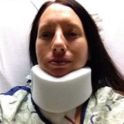 picture of me after cervical double disc replacement surgery